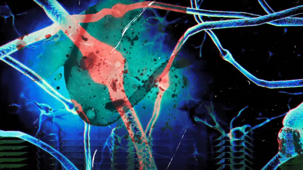 glitched neurons
